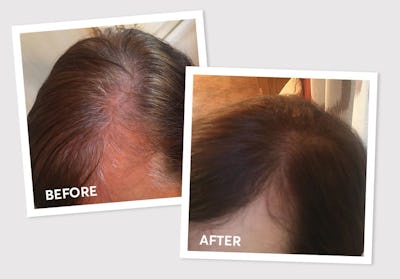 Woman's hair before and after using Madison Reed's Tuscany Brown Hair Color