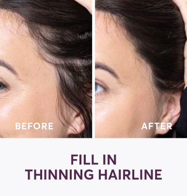 fill in thinning hairline before after